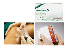 MEDICAZIONE STERILE IN FILM IN POLIURETANO TRASP. SUPRASORB F 10X12CM 10 PEZZI - Farmaunclick.it
