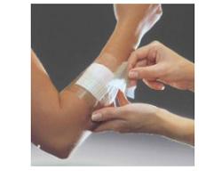 FILM ADESIVO IN POLIURETANO OPSITE FLEXIFIX IN ROTOLO TRASPARENTE IMPERMEABILE PER FISSAGGIO DI MEDICAZIONI E CATETERI LARGHEZZA 15 CM LUNGHEZZA 10 M 1 PEZZO - Farmaunclick.it