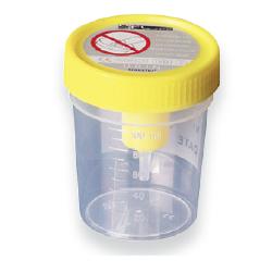 CONTENITORE URINA STERILE MEDIPRESTERIL CON SISTEMA TRANSFERT PER PROVETTE SOTTOVUOTO - Farmaunclick.it